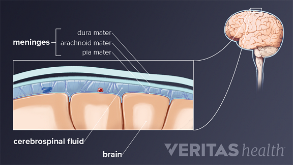 Meningitis anatomy